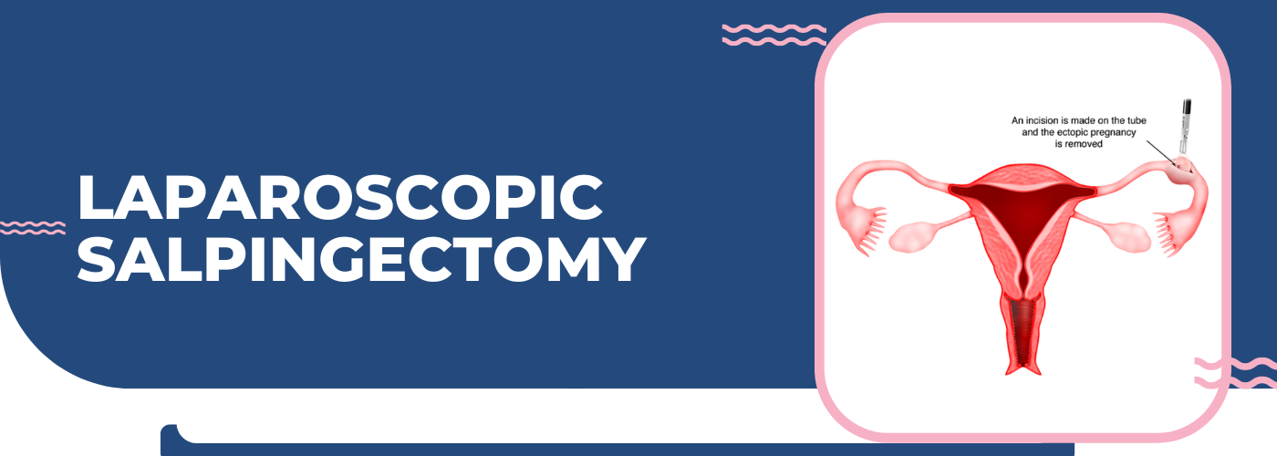 Laparoscopic_Salpingectomy